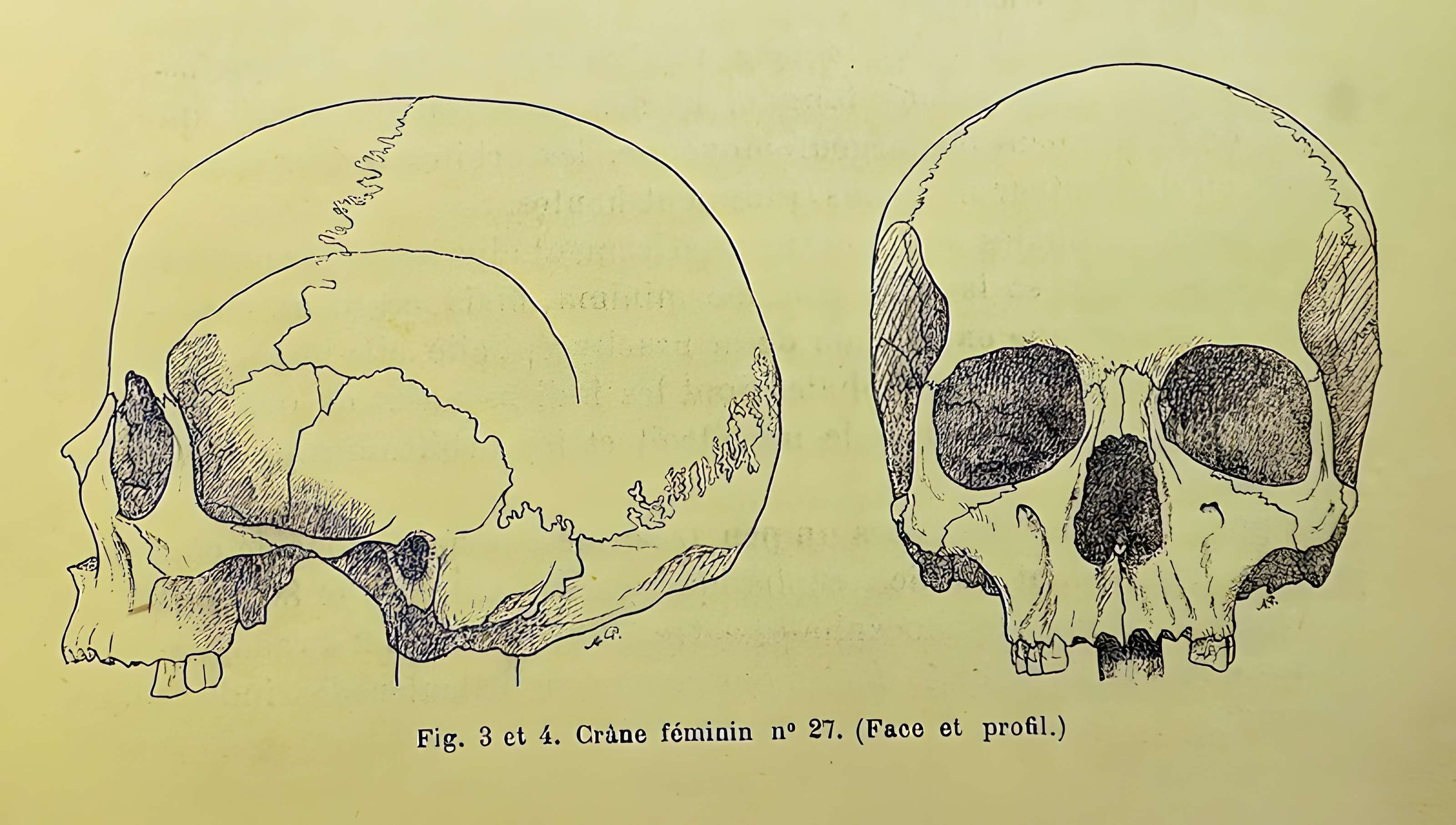Bibliothèque Georges-Pompidou de Châlons-en-Champagne