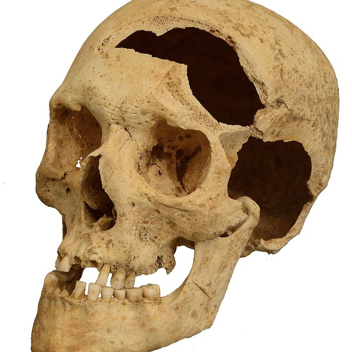 Photo de Musée archéologique de Strasbourg