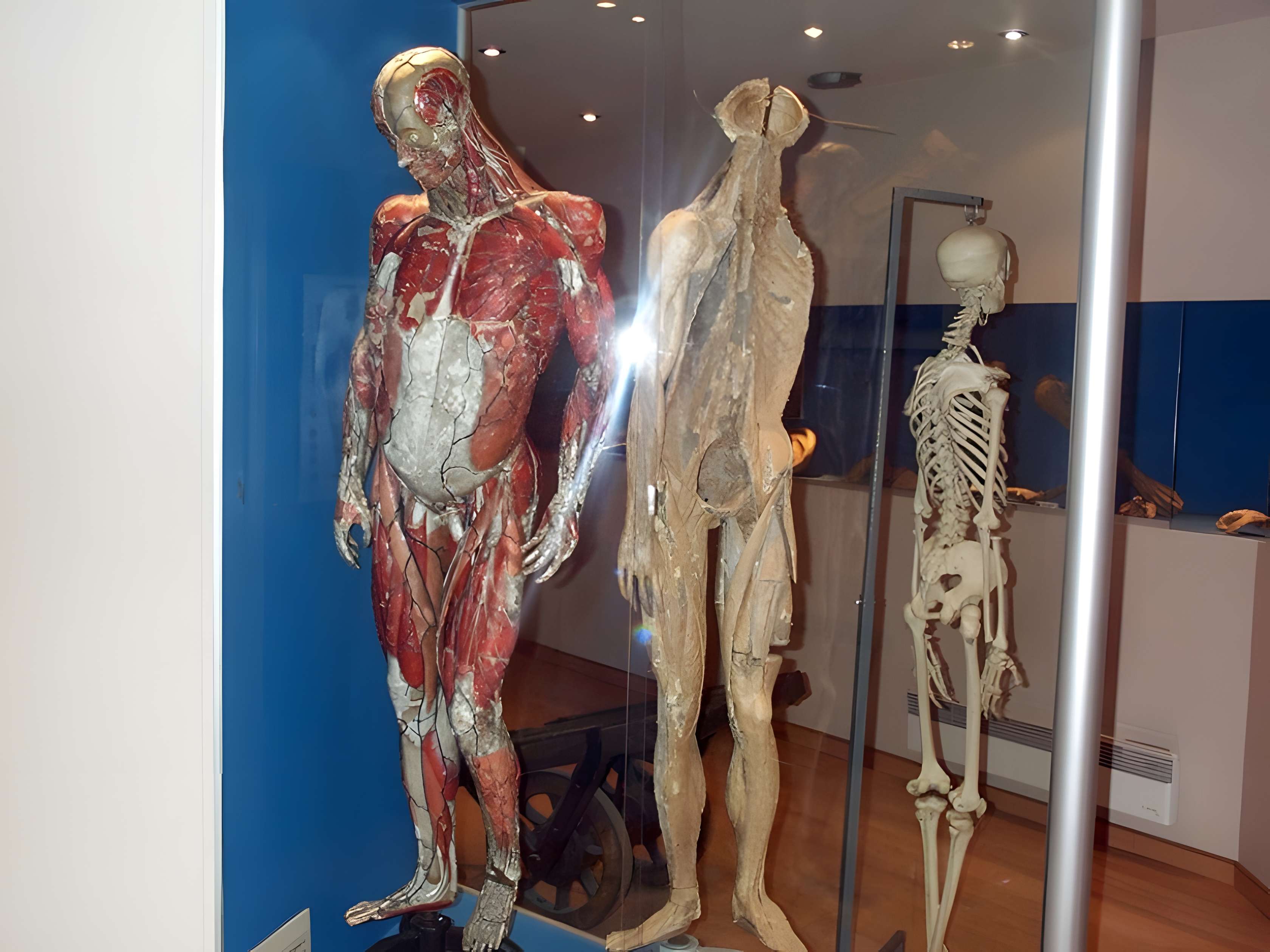 Musée de l'écorché d'anatomie au Neubourg 