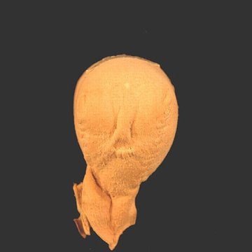 Musée Flaubert et dhistoire de la médecine à Rouen