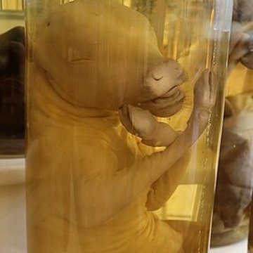 Musée Fragonard de lÉcole vétérinaire de Maisons-Alfort