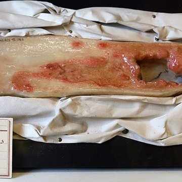 Musée Fragonard de lÉcole vétérinaire de Maisons-Alfort