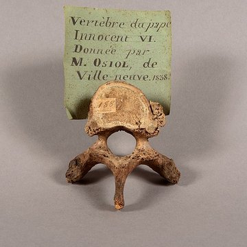 Musée Calvet et musée Lapidaire