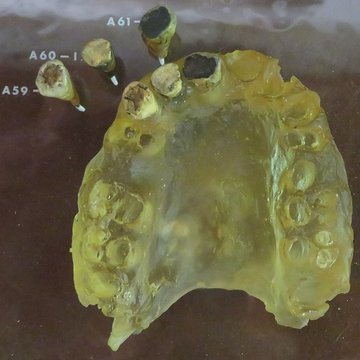 Grotte de la Caune de lArago