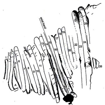 Gisement paléolithique de la Roche-Cotard